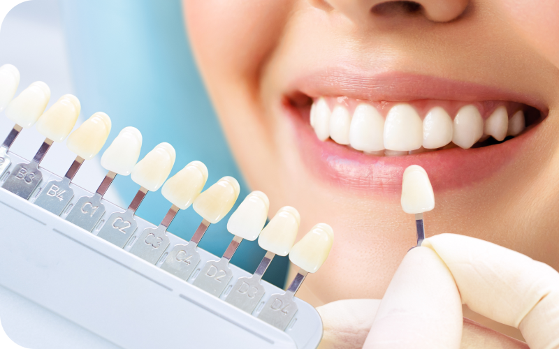 ホワイトニングとは