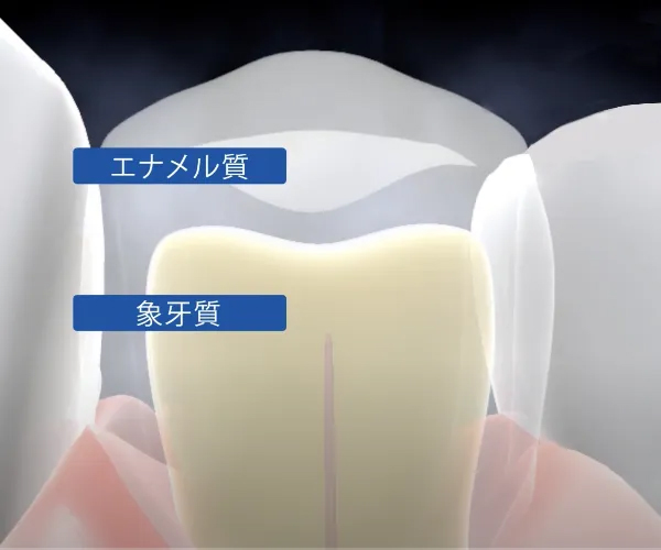 自分の好きな時間でできるホワイトニングです。